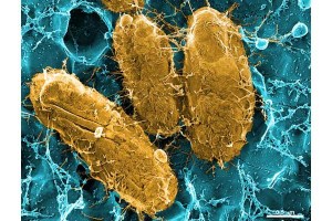 Electron microscopy of UPEC binding to the surface of the bladder (Source)