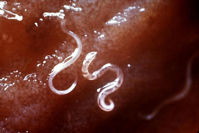 Hookworms attached to the intestinal wall. (Source)