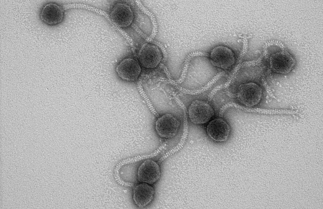 A transmission electron micrograph of phage JBD37. This phage does not contain an anti-CRISPR and is targeted by the CRISPR-Cas system in Pseudomonas aeruginosa. (Credit: Joe Bondy-Denomy) XpixCal=3.36 YpixCal=3.36 Unit=nm ##fv3